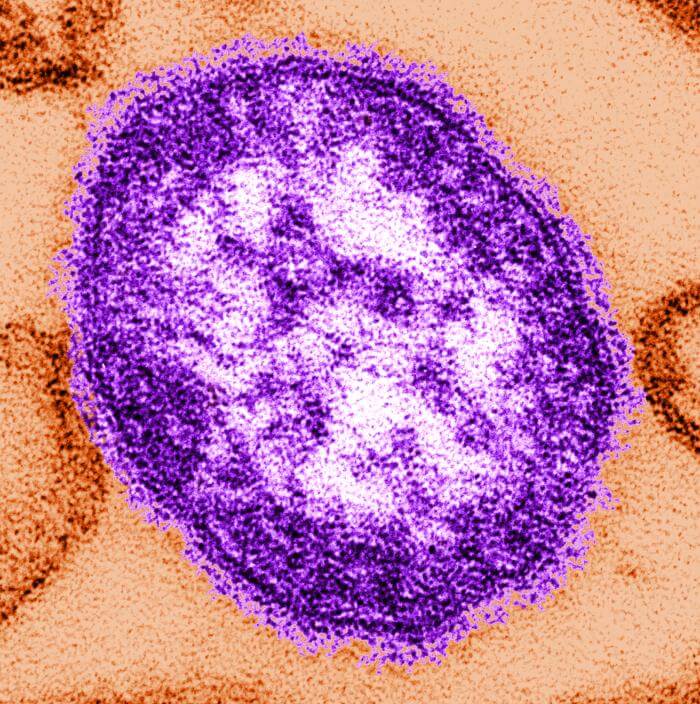 Public health officials warn of rise in measles, as Virginia. hantavirus patient under monitor