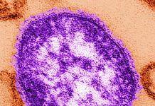 Public health officials warn of rise in measles, as Virginia. hantavirus patient under monitor